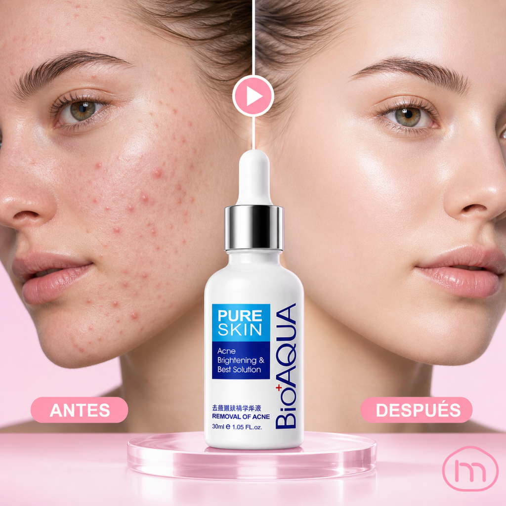 SERUM FACIAL ANTI-ACNE