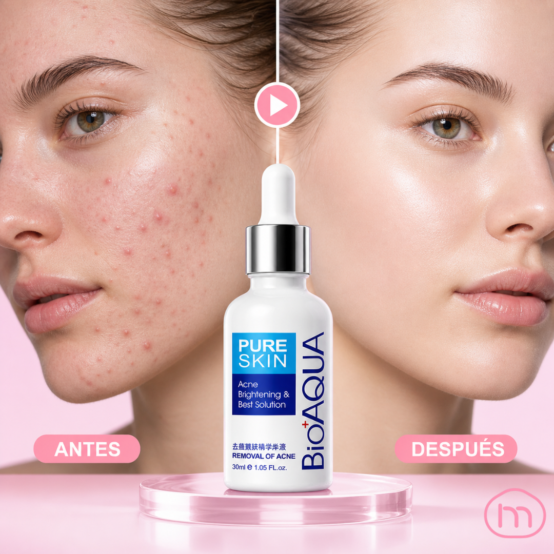 SERUM FACIAL ANTI-ACNE